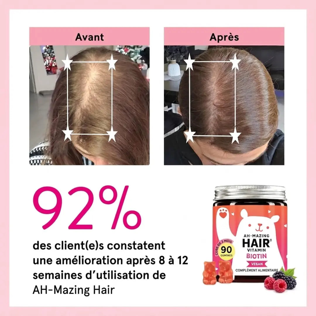 Sorlyn – Biotin Gummies for Hair Growth: Less hair loss, more confidence