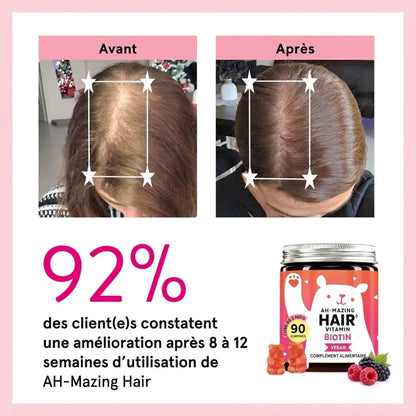 Sorlyn – Biotin Gummies for Hair Growth: Less hair loss, more confidence