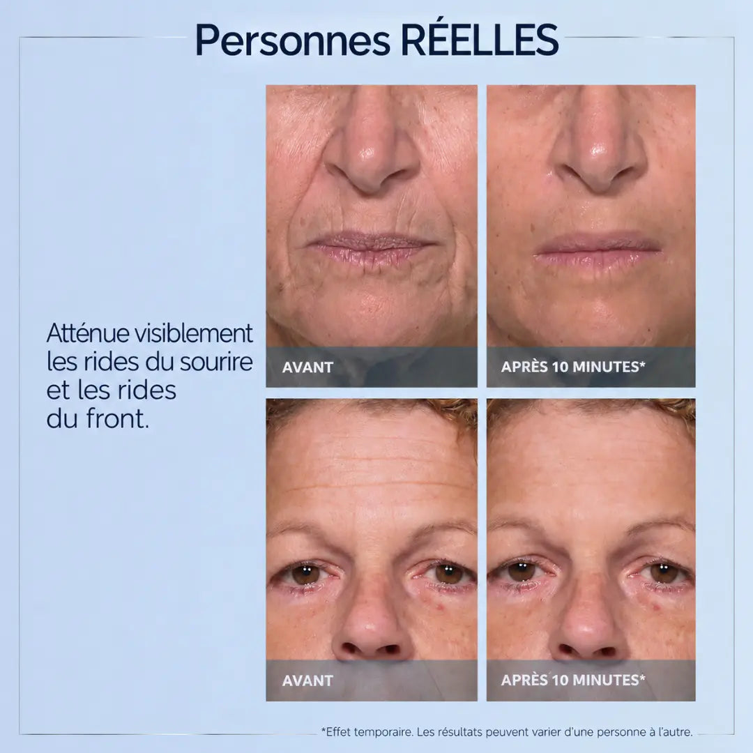 SORLYN Rapid Reduction Eye Serum – visibly reduces under-eye bags, wrinkles, dark circles, fine lines, and crow's feet