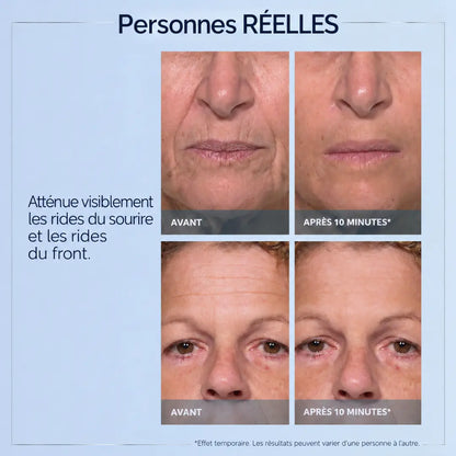 SORLYN Rapid Reduction Eye Serum – visibly reduces under-eye bags, wrinkles, dark circles, fine lines, and crow's feet